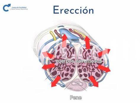 Causas Comunes De La Fuga Venosa En Hombres